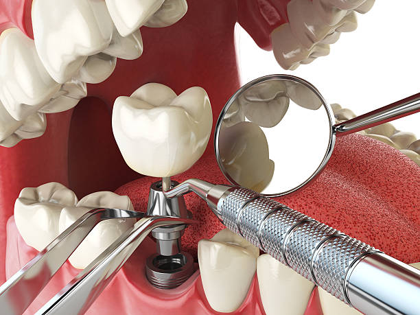 Best Emergency Dental Services for Seniors in Birchwood Lakes, PA